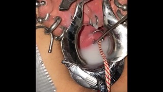 Rough Cervix Sounding Creampie Piercing
